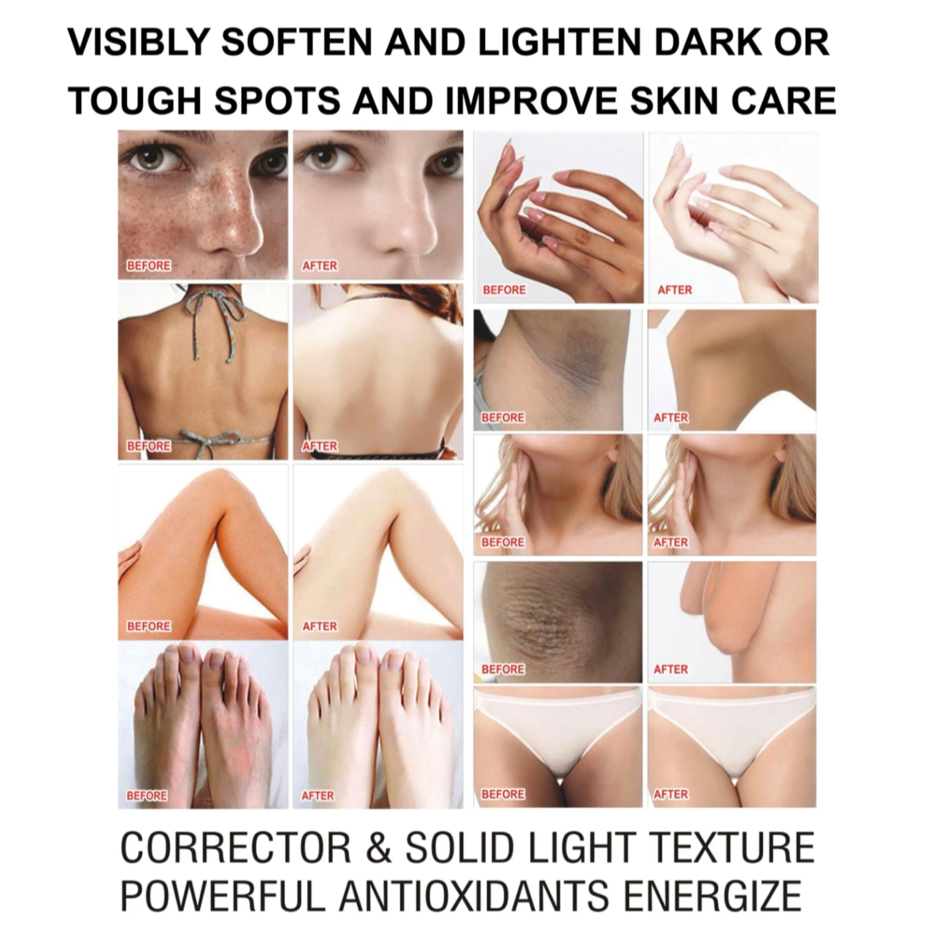 Private Label Super Whitening Body Lotion – Brighten & Soften Skin