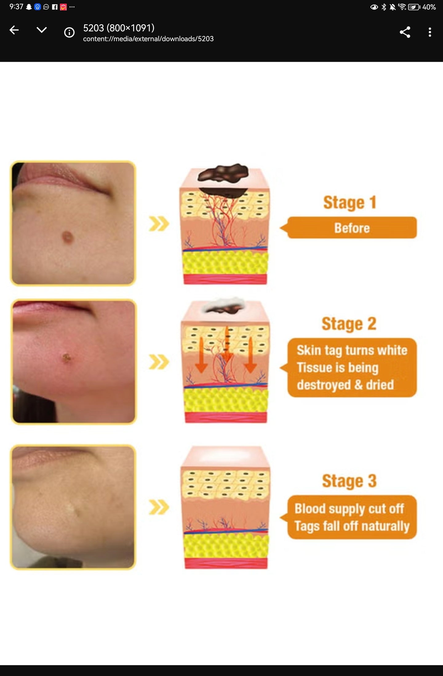 Bee Venom Repair Cream – Professional Treatment for Face & Body