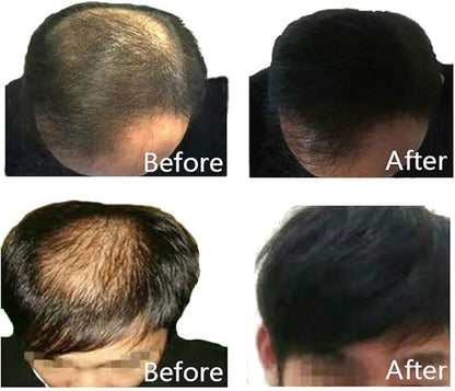 Lose Hair Building Fibres Dark Brown