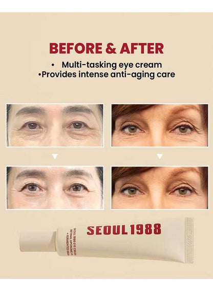 Seoul 1988 Eye Cream ℗